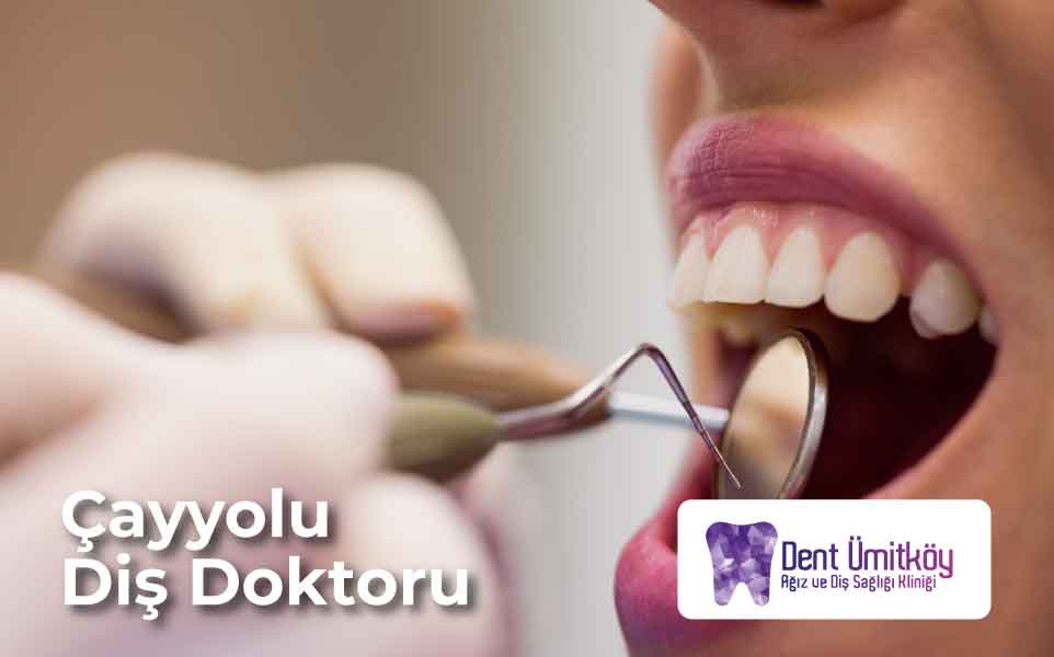 Çayyolu Diş Doktoru: Sağlıklı ve Estetik Gülüş İçin Profesyonel Çözümler
