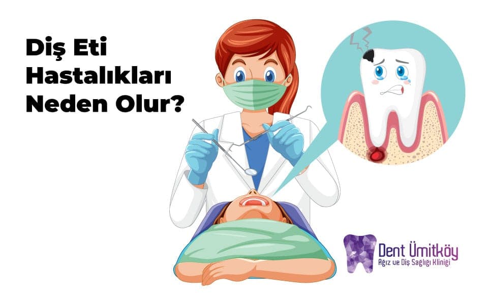 Diş Eti Hastalıkları Neden Olur? Gizli Tehlikenin Kaynakları