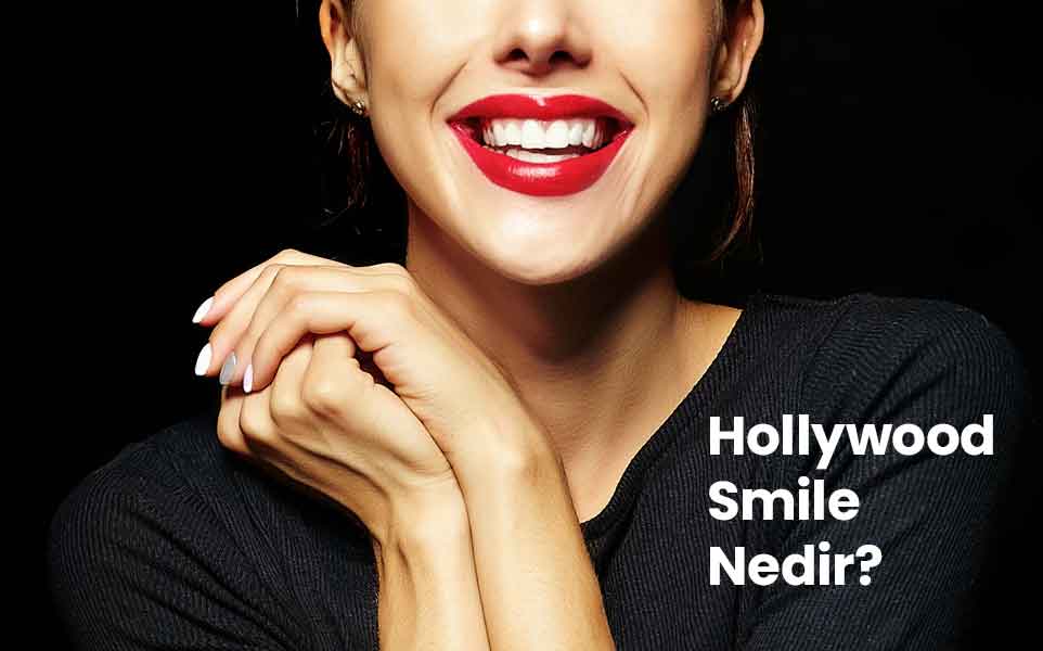 Hollywood Smile Fiyatını Etkileyen Faktörler Nelerdir?