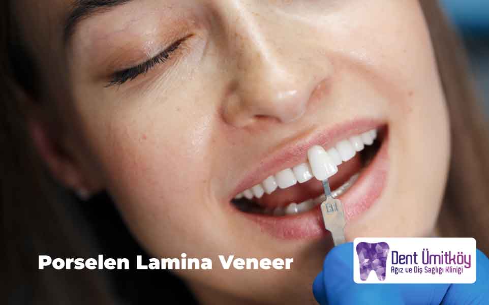 Porselen Lamina Veneer Ankara